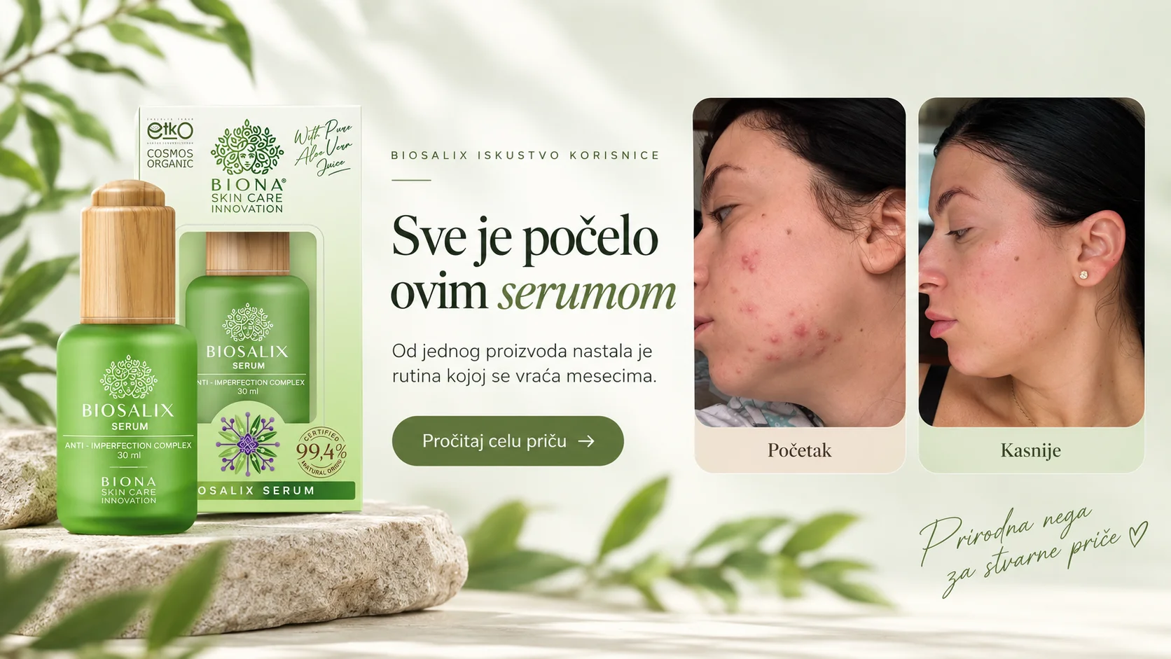 Biona BioSalix iskustva