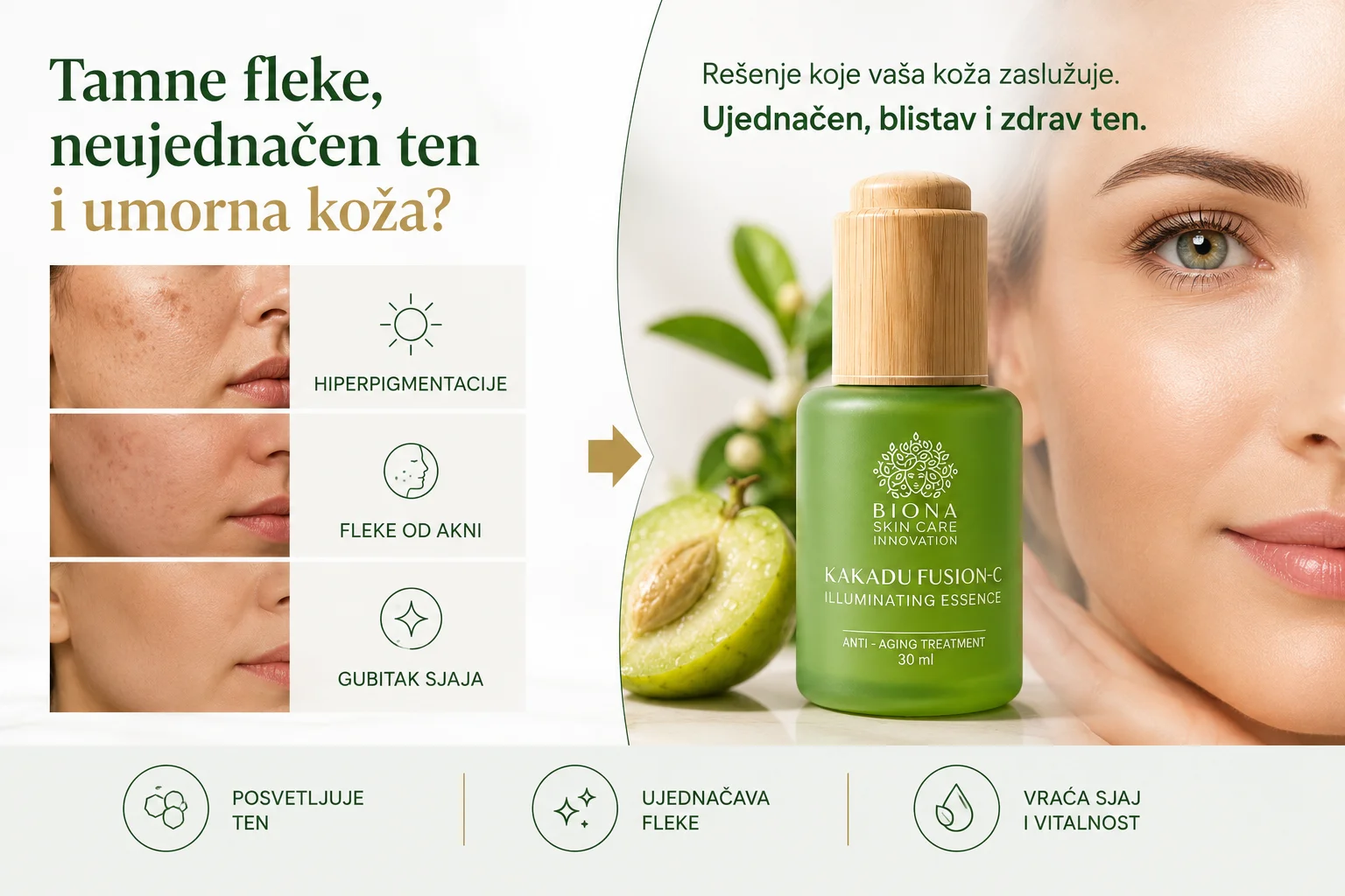 Tamne fleke, neujednačen ten