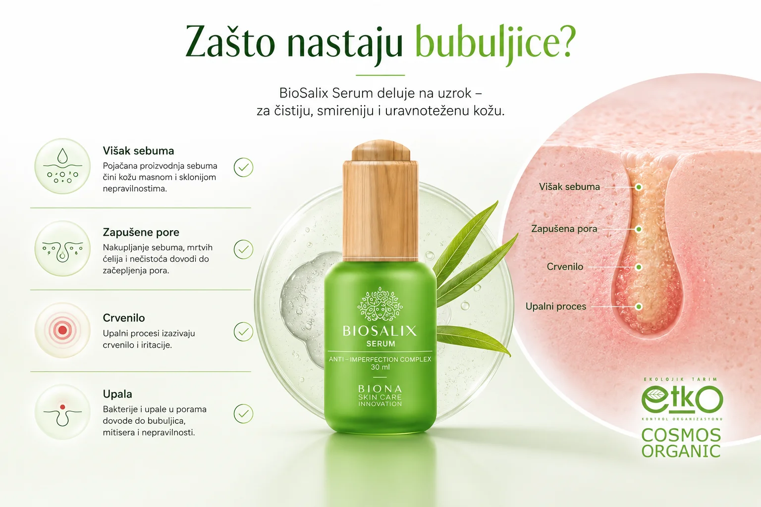 Zašto nastaju bubuljice